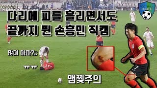 [축구직캠] 다리에 피를 흘리면서도 끝까지 뛴 손흥민...맴찢주의