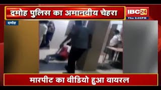 Damoh Police का अमानवीय चेहरा आया सामने | मारपीट का Video हुआ Viral