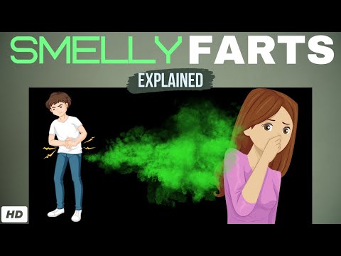 Causes Of Smelly Farts Sengeek Causes Of Smelly Farts Sengeek
