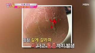 발 혈액순환 방해하는 '이것'의 정체는?!