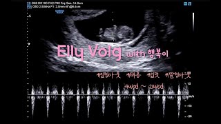 Elly Vlog #27 계획임신 준비부터 21주 중기까지┃임밍아웃┃태몽🍑┃입덧┃성별확인👶🏻💗