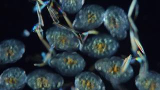 ミジンコの発生過程(developing process of Daphnia pulex)　【淡水のプランクトン】