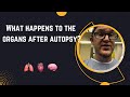 What Happens To The Organs After Autopsy? #autopsy #forensics #doctor