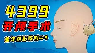 因太过吓人而遭到下架的4399手术系列！？带你真实体验开颅手术的全过程！？