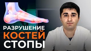 Тайна болезни Ренадера-Мюллера: Почему болит палец стопы и как избавиться от боли?