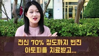 간증클립 - 머리부터 발끝까지 전신 70% 정도까지 번진 아토피를 치료받고 (만민중앙교회,이재록 목사,지씨엔방송)