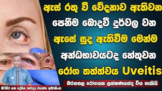 ඇස් රතු වී වේදනාව ඇතිවන, පෙනීම බොදවීම, ඇසේ සුද ඇතිවීම සහ ඇස් අන්ධභාවයටද හේතුවන රෝග තත්ත්වය | Uveitis