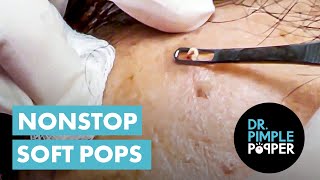 Nonstop Soft Pops