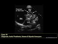 echo case 81 echocardiography spot diagnosis series echocardiogram interpretation made easy