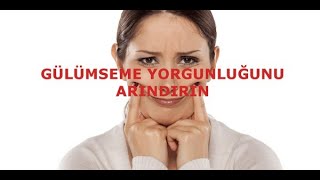 Gülümseme Yorgunluğu