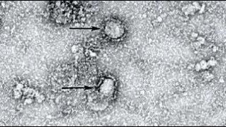 Incubation period of the novel coronavirus could be as long as 24 days