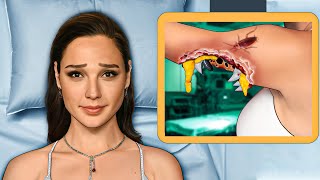 ASMR Remove Maggot Infected Arm - Deep Cleaning Animation