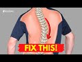 How to Relieve Your Scoliosis Back Pain in 30 SECONDS