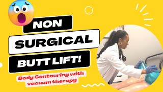 Butt Lift Without Surgery! Vacuum Therapy Body Contouring