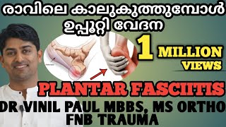 E3: ഉപ്പൂറ്റി വേദന | PLANTAR FASCIITIS MALAYALAM | നിങ്ങൾ അറിഞ്ഞിരിക്കേണ്ടതെല്ലാം | DR VINIL PAUL MS