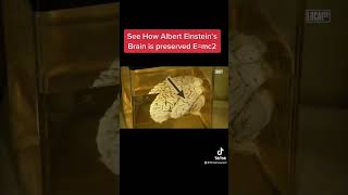 See How Albert Einstein’s Brain is Preserved ❤️😮#shorts #youtubeshorts