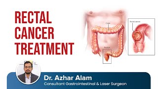 Rectal Cancer Diagnosis and Treatment by Dr Azhar Alam