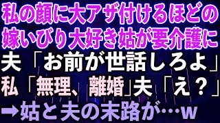 【スカッとする話】私の顔に大アザを付けるほどの嫁いびり大好き姑が要介護に。夫「お前が世話しろよ」私「無理、離婚」夫「え？」➡︎姑と夫の末路が…