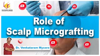 The Role of Scalp Micrografting | Dr. Venkataram Mysore | The Venkat Center, Bengaluru