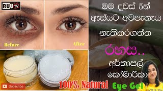 මම දවස් 5න් ඇස්යට අවපැහැය නැතිකරගත්ත රහස | Remove Dark Circles in 5 Days | Potato Aloe vera eye Gel