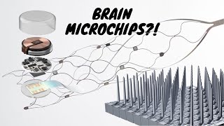 Neuralink Successfully Tests New Brain Implant - Here's What It Can Do