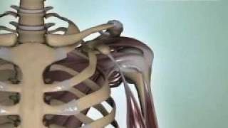 Shoulder Arthritis - DePuy Videos