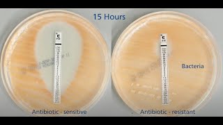 Antimicrobial Resistance - A view from the laboratory