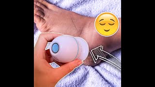 INOVATIVE- ELECTRIC CALLUS REMOVER