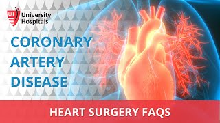 Heart Surgery FAQs - Coronary Artery Disease