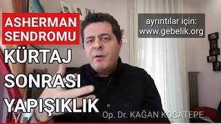 Kürtaj sonrası adet görememe veya az kanama rahim içi yapışıklık (Asherman sendromu) olabilir mi?