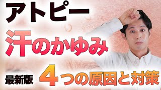 2022年版 アトピー改善のための４つの汗によるかゆみ対策