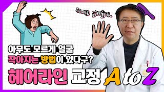 [성형정보] 얼굴 작아지는 방법이 있다구??😲👉🏻헤어라인교정 A to Z ｜#헤어라인 #모발이식