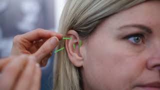 Icaria | Natural Wellness Auricular Therapy