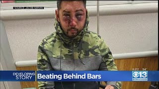 Man Beaten Behind Bars