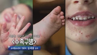 [TV메디컬 약손]20221004(652회)가을철, 영유아 감염병 주의보_수족구병_소아청소년과 전문의 김세윤 교수