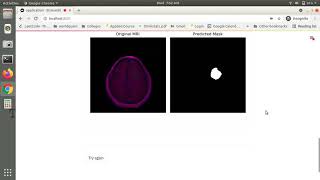 Brain MRI segmentation deployed application on streamlit
