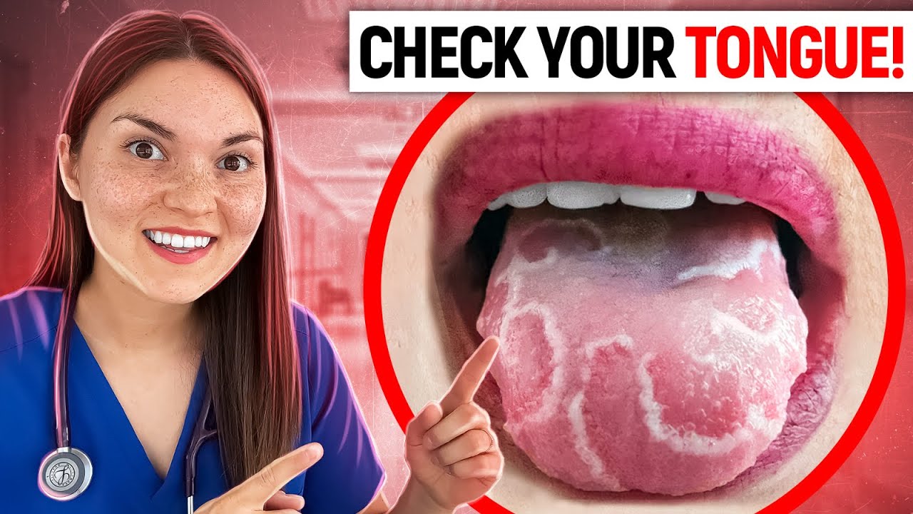 What Your TONGUE Says About Your HEALTH: Doctor Explains - YouTube