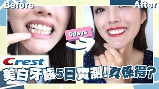 美白Challenge accepted！ 5日實試Crest美白牙齒！效果到底係點？｜Sulinip