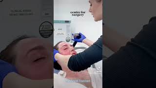 Morpheus8 SKIN TIGHTENING | London UK | Centre for Surgery #fyp