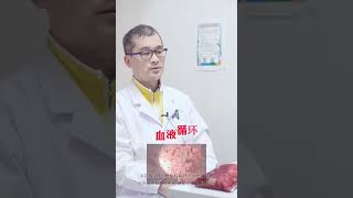 血管狭窄，建议做这四种运动，对血管狭窄有帮助#中医 #健康