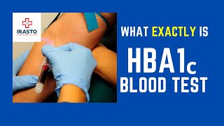 What is the HBA1c Blood Test for Diabetes ?