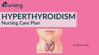 Nursing Care Plan for Hyperthyroidism (Nursing Care Plan Tutorial)