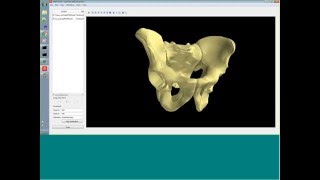 Webinar: Patient-specific Modeling & Scaling with MAP & Statistical Shape Modeling