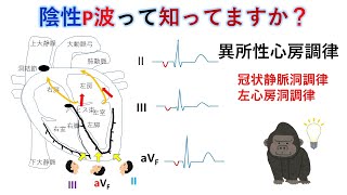 心電図：暗記からの卒業 26話 心房負荷とP波