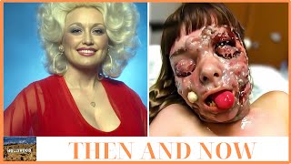 Was a Famous Actress Before His Plastic Surgery, Guess Who | Then and Now 2025