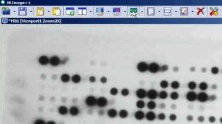 Gene Array Analysis Using HLImage++
