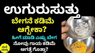 ಉಗುರುಸುತ್ತು ನೋವು ಬೇಗನೆ ಕಡಿಮೆ ಆಗ್ಬೇಕಾ? | Uguru Suttu Home Remedies | Fungal Infection in Nails | Tips