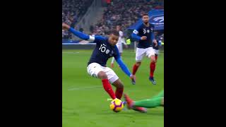 Mbappe Injury Moments 😥