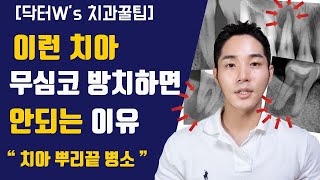 치아 뿌리 고름주머니, 꼭 경과관찰 하셔야 합니다.