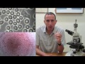 בדיקת דם מיקרוסקופית live blood microscopy כיצד אתם יודעים אם התזונה בריאה ד